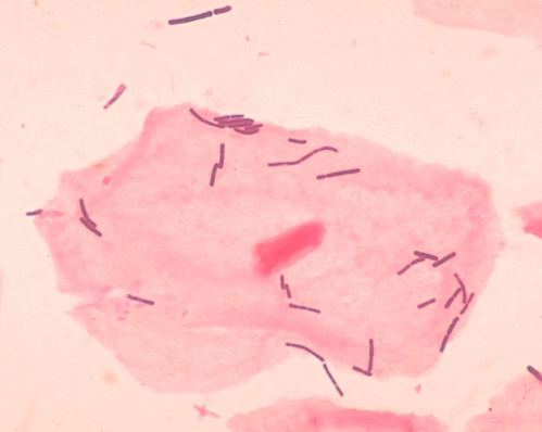Lactobacillus_wiki