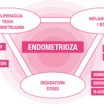 endometrioza-foto